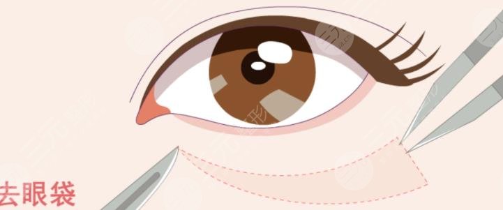 眼袋