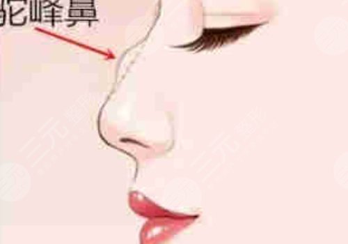 西安金长鑫做鼻子怎么样?