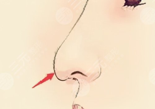 西安金长鑫做鼻子怎么样?