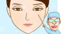 激光双眼皮和正常开刀哪个好？手术原理是什么？注意事项分享