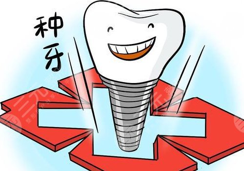 种一颗牙多少钱?可以维持多久?