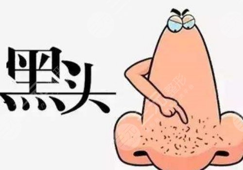 如何去鼻子上的黑头?