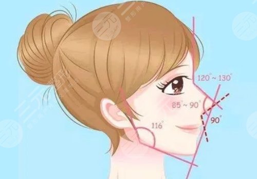 塌鼻子隆鼻后会好看吗?