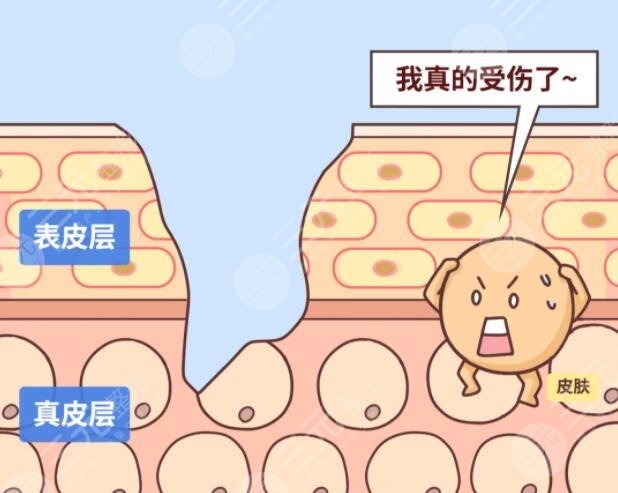 疤痕是怎样形成的?