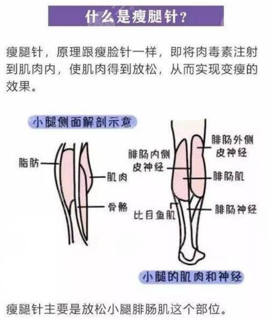 肌肉小腿怎么瘦成筷子腿肚子?