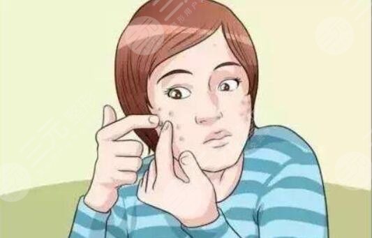 痤疮疤痕怎么治才能彻底?