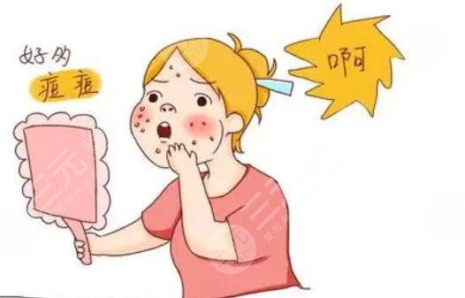 痤疮产生的原因