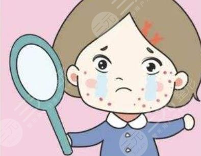 青春痘