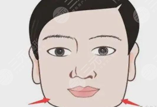 下颌角