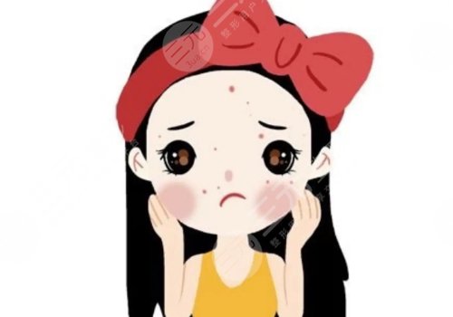 去痘价格大概多少?