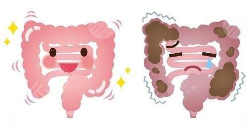 清肠道排宿便有的方法有哪些?