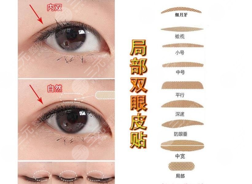 内双怎么贴双眼皮贴?