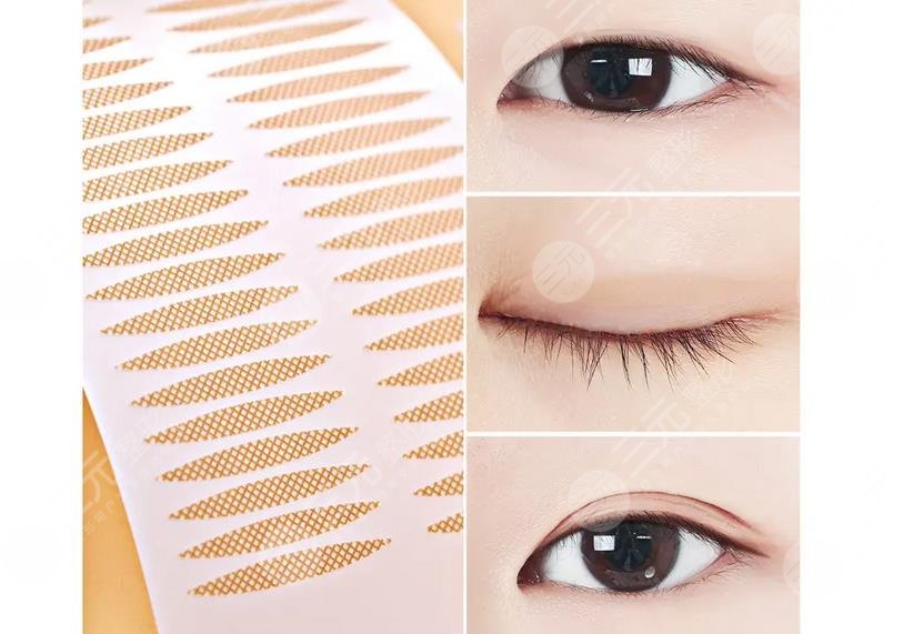 内双适合什么样的双眼皮贴呢?