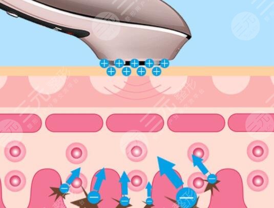 彩光超音波美容仪有用吗?