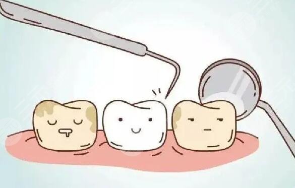 beyond冷光牙齿美白价格