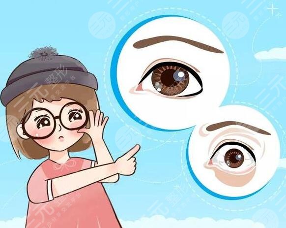 金鱼眼整形矫正方法