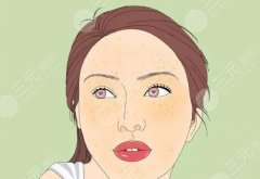 如何去蝴蝶斑？蝴蝶斑形成？激光去蝴蝶斑的果怎么样？
