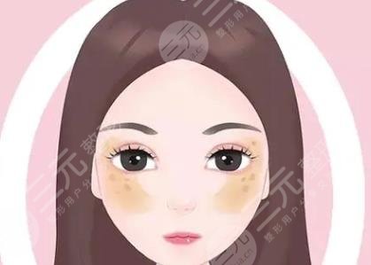 黄褐斑
