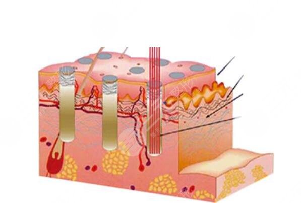 复合彩光祛痘需要多少钱?