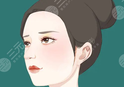 耳软骨隆鼻需要多少钱?