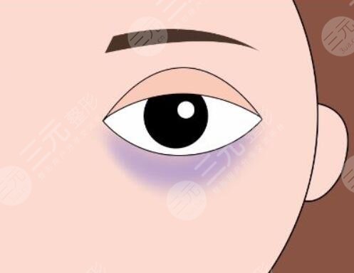 　　吃什么缓解黑眼圈果好又快速?黑眼圈可以说是我们的灾难，稍微不注意黑眼圈就悄悄的冒了出来，即便拥有一张白皙靓丽的脸庞也忍受不了黑眼圈的出现，黑黑的黑眼圈一旦出现在脸上，就会让我们看起来没有精神，整个人焉了吧唧的。为了解决免不黑眼圈的问题，大家各种各样的方法都是使用，目前使用的比较多的是使用各种各样的眼霜，或者是通过医美整形的方式来改良，又或者是通过饮食的改变来改良黑眼圈的问题，那么吃什么缓解黑眼圈?现在就和小编一起来认真的做一下功课吧!  　　一、黑眼圈是怎么出现的?  　　黑眼圈出现的原因有很多种，比较常见的一种是长时间的熬夜，导致眼部疲劳血液流通不畅，出现了紫红色或者是青色的黑眼圈。还有一种是色素性黑眼圈，出现这种情况的原因有很多中，不单单是因为熬夜导致的，还有一些外界因素的印象，主要指因为长时间在阳光下暴晒，过多的药物摄入，做了一些眼部手术等等，以及买了一些不适合自己的化妆品，引发了眼周荨麻疹反映，都会导致眼周出现色素沉淀，对于这种色素性黑眼圈，主要是叫撒后这些黑色的细胞，减少黑色色素。  　　二、吃什么缓解黑眼圈果好又快速?  　　既然有黑眼圈的出现，就要积极的找到一个有的缓解方式，目前就有很多人说可以通过食物来改良黑眼圈的问题。那么具体吃哪些东西比较有果了?  　　1、摄入高蛋白的食物，高蛋白的食物有很多种，主要是牛奶，鸡蛋以及各种肉类，积极增加自己的蛋白质摄入，可以有的缓解黑眼圈的形成，但是对高蛋白食物过敏的小伙伴，不建议使用这一种方法，大家可以通过其他的方式来改良自己黑眼圈的问题。  　　2、可以尝试多吃一些动物的肝脏等食物，这些食物内部含有为丰富的维生素a，这个维生素可以很好的为我们眼周和眼球提供必需的物质，促进眼周的血液循环，帮助缓解黑眼圈。同时吃各种各样有营养的食物来改良黑圈，也是一个比较好的选择，大家可以根据自身的条件来制定一个比较不错的食谱。  　　三、医美整形手术改良黑眼圈  　　除了通过吃东西来改良黑眼圈以外，还有一种可实施比较有的方法，那就是通过医美整形的方式来改良黑眼圈。目前针对黑眼圈的医美整形项目也有几个，小编整理了一些作用果不错的几个项目，现在就分享给大家吧!  　　1、激光缓解黑眼圈  　　激光缓解黑眼圈是一个比较常见的医美整形项目，也是当下行之有的一种技术手段，他的操作难度不高，主要是通过激光的远红外长脉冲激光，作用在眼周的皮肤上，慢慢的渗透到皮肤深层，让激光产生的爆破光热能量将这些黑色素打散，改良皮肤的生成代谢，促进胶原代表的生成，在有去除黑眼圈的同时，也能样眼周的皮肤更将光泽有弹性。这种激光缓解黑眼圈的方式一般适用于是色素性黑眼圈。  　　2、注射缓解黑眼圈  　　如果是结构性的黑眼圈，一般采用玻尿酸或者是脂肪来进行局部的注射填充来改良，这种黑眼圈一般是出现在家族遗传病史上，随着年纪的增加，到了十五六岁的时候就会出现结构性的黑眼圈，这时候就可以采取局部注射缓解大，可以很好的减少这种情况的出现，既而改良黑眼圈的情况。想要通过医美整形手段改良自己的黑眼圈情况的小伙伴，一定要去正规的整形机构做手术，并且了解到自己出现黑眼圈的原因，才能制定一个可行的手术方案。