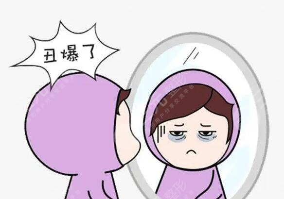 医美整形手术改良黑眼圈