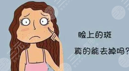 祛斑