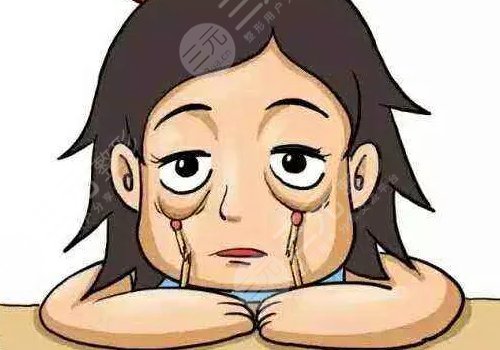 不手术去眼袋的方法有哪些?