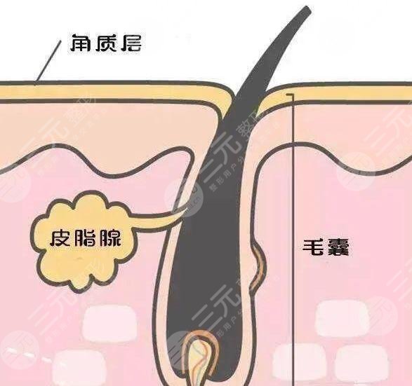 黑头导出液哪个好用?