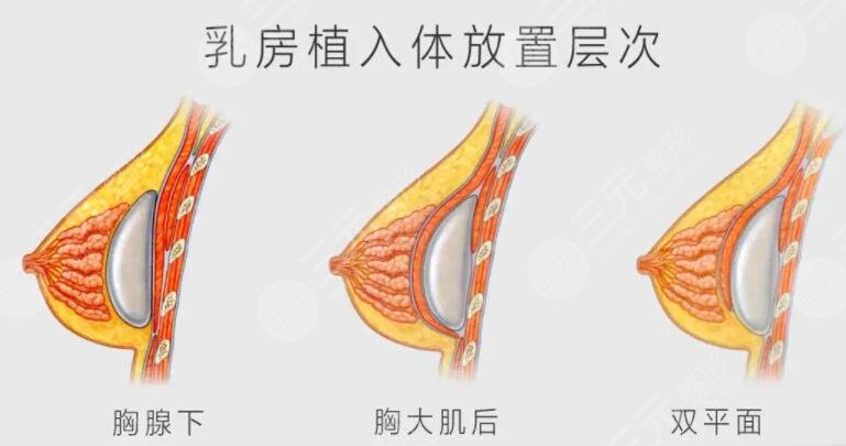 妙桃琴面丰胸的注意事项