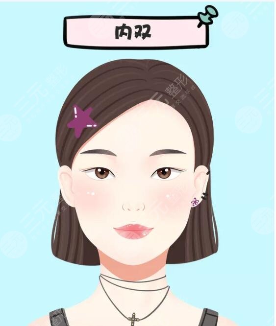 眼部|做内双眼皮手术多少钱？超全双眼皮手术科普帖，建议好好收藏~