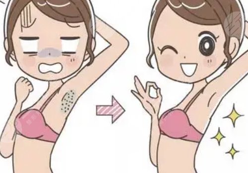 有没有脱毛好方法?