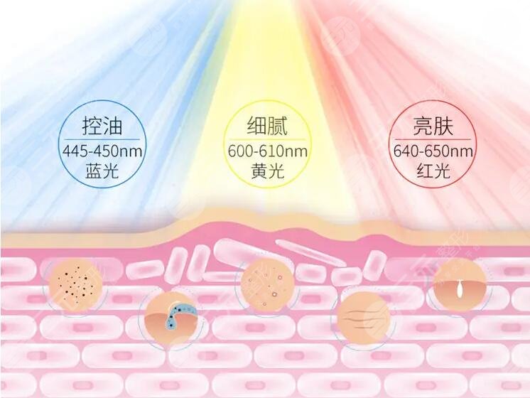 激光嫩肤的准备和护理工作