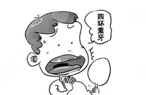 四环素牙烤瓷牙的价格