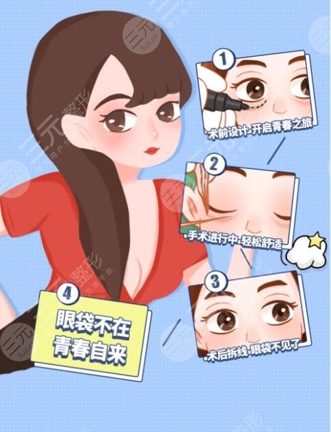 去眼袋需要多少钱费用?