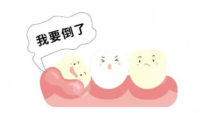 牙周炎牙齿松动原因解析