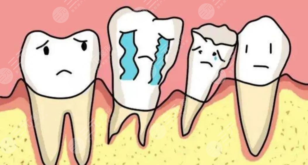 牙周炎牙齿松动原因解析