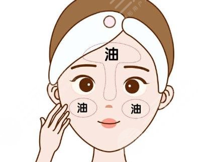 油性皮肤