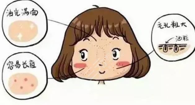 油性皮肤护理方法有哪些?肌肤容易出油的原因是什么?