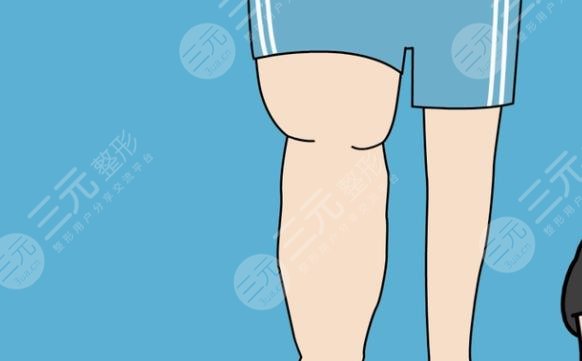 小腿吸脂