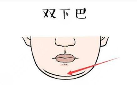 双下巴