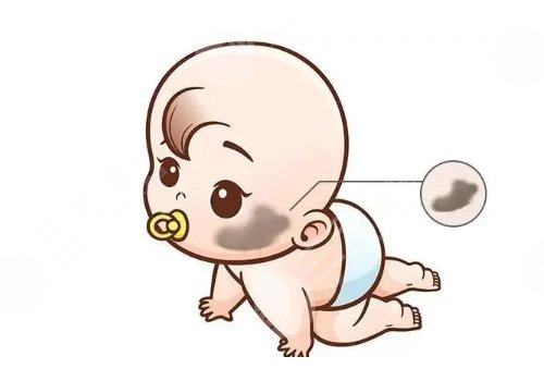 苏州祛胎记多少钱?