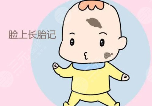 苏州祛胎记多少钱?