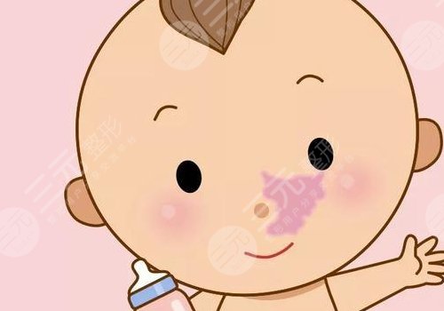 苏州祛胎记多少钱?