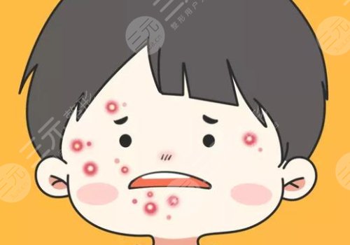 彩光祛痘果怎么样?