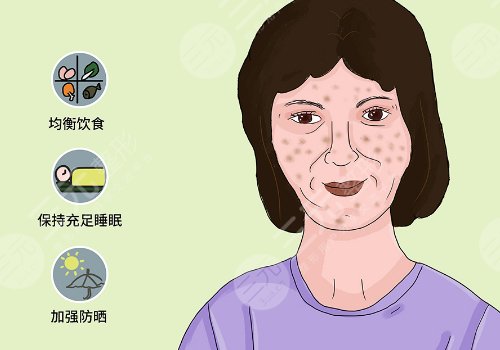 怎样祛斑果好些?