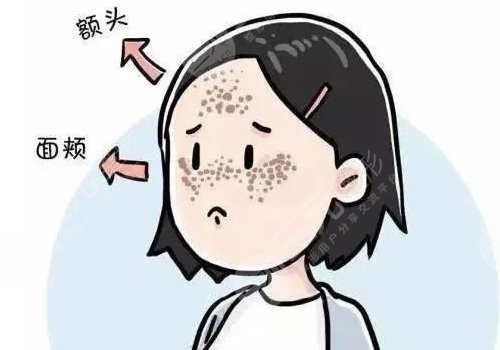 怎样祛斑果好些?