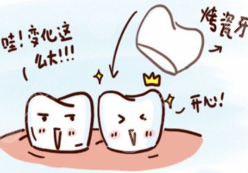 烤瓷牙价格表2023更新