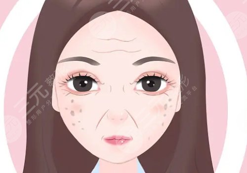 怎样治老年斑？