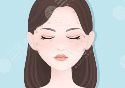 怎样治老年斑？